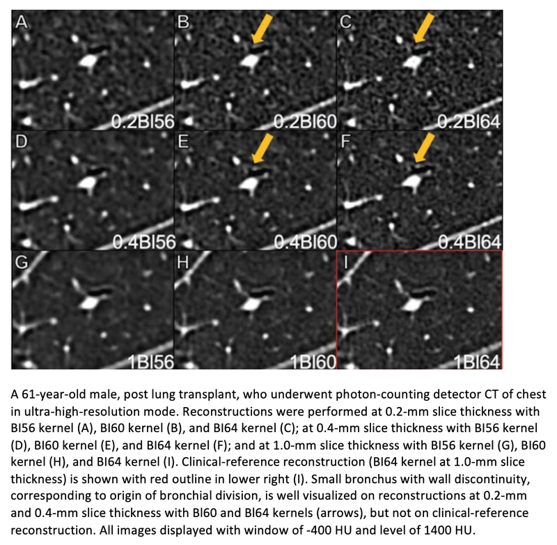Kernel and Slice Thickness Matter in Photon-Counting CT Lung Imaging