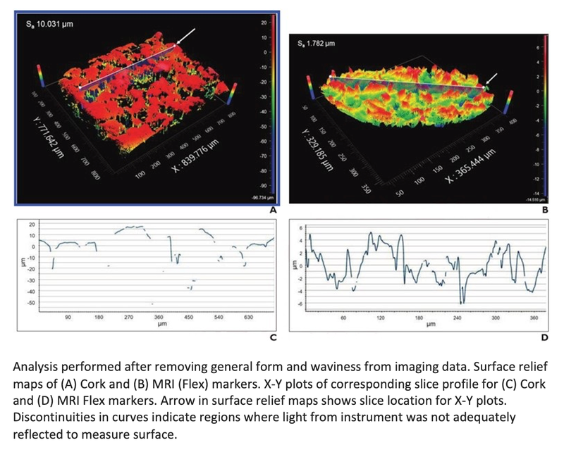 Ultrasound Color Doppler Twinkling Useful for Detecting Breast Biopsy Markers