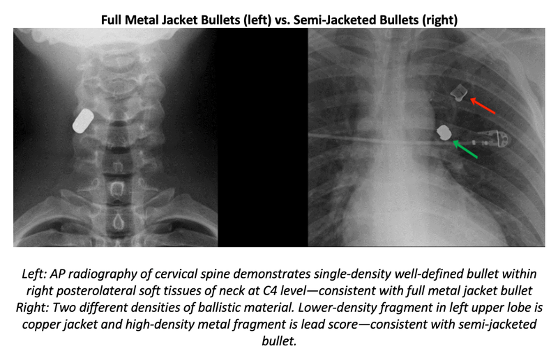 ARRS 2022: Updated Primer on Imaging Ballistic Injuries