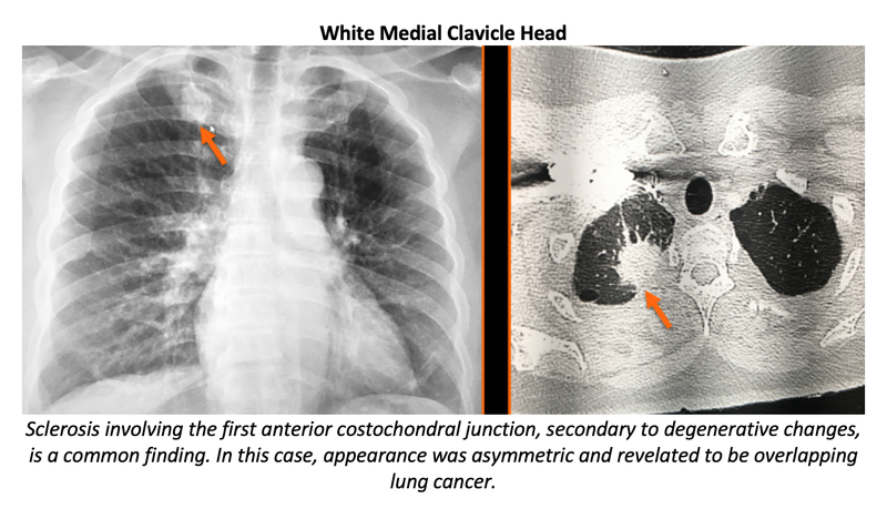 ARRS 2022: Inattention Blindness in Emergency Imaging Cases