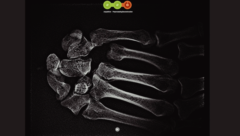 Adaptix Limited Files for FDA Clearance of Point-of-Care 3D Imaging System