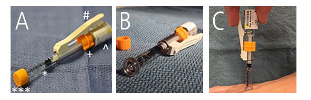 Approach to local anesthesia in children