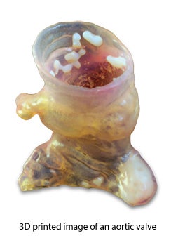 RSNA 2015: 3D Printing on Demand with Vitrea Advanced Visualization Software