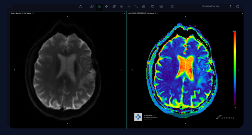 Ambra, Arterys Partner to Integrate AI Applications into Clinical Workflows