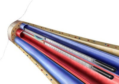 CONNECT-AV Trial for Endovascular AV Fistula Treatment Begins Patient Enrollment