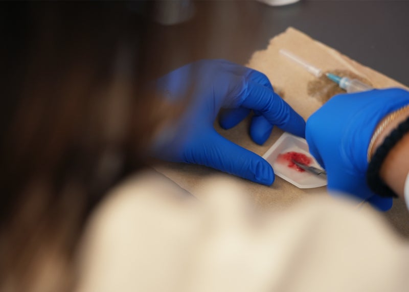 Research Suggests Connection Between Covid-19 and Cancer Regression