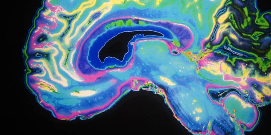 Biogen Providing Aduhelm Free to Some Patients