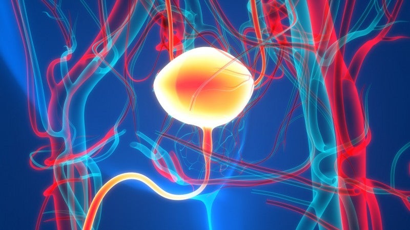 Novel PET Tracer Offers Same-Day Imaging for Aggressive Breast and Bladder Cancers
