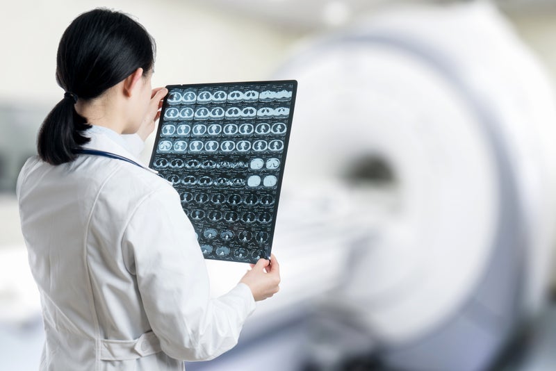 Novel Technology Could Increase MRI Scan Speeds