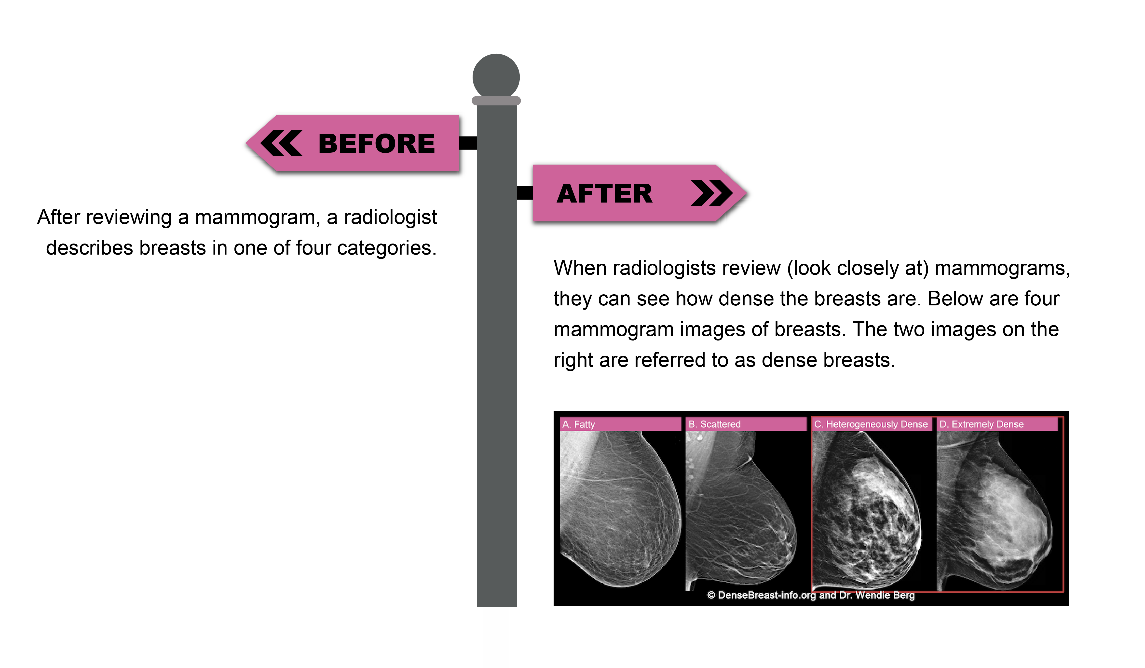 DenseBreast-info.org Updates Patient Educational Materials