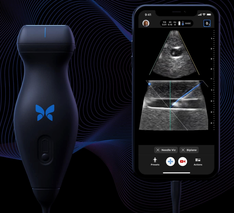 Butterfly, Ambra Partner on Ultrasound Data Integration