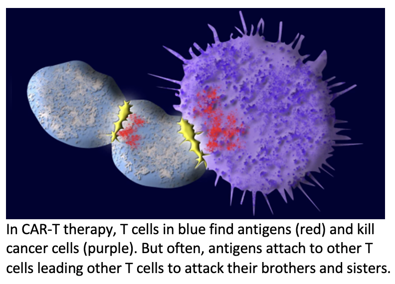 CAR-T Therapy Not Cost Effective for Diffuse Large B-Cell Lymphoma