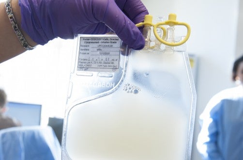 Novel CAR T Cell Demonstrates High Response Rates in Adult Advanced B-Cell ALL Patients