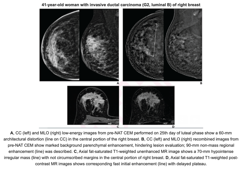 Contrast-Enhanced Mammography After Neoadjuvant Therapy May be Useful if No MRI