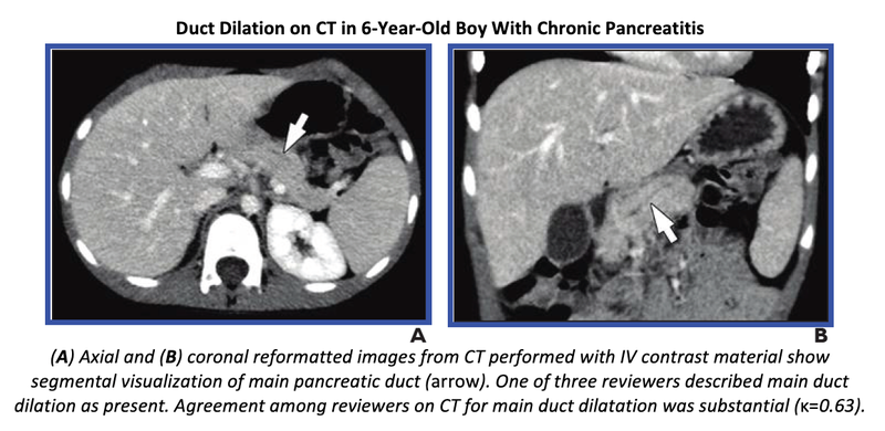 Study Highlights Need for Objective Criteria When Using CT and MRI for Pediatric Pancreatitis