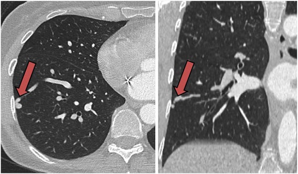 AI-Based Reference Charts Enhance Understanding of CT Imaging Volumes