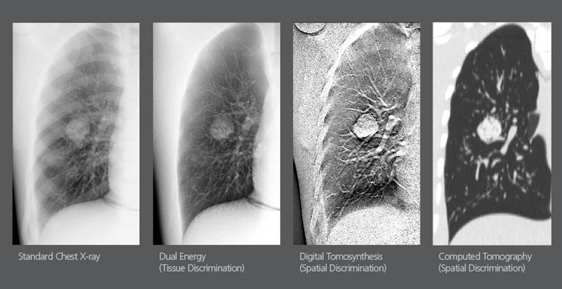 Carestream, Robarts Research Institute Partner on Cardiothoracic and Pulmonary Research
