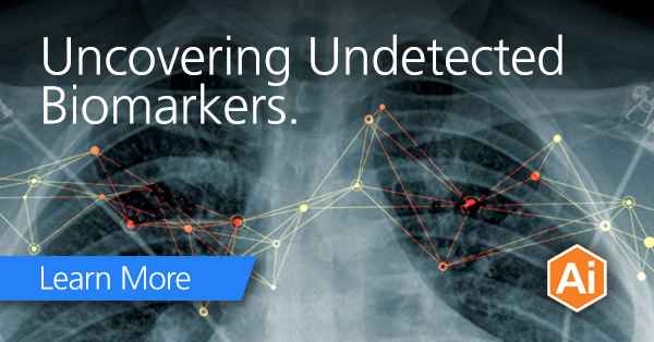 Consortium to Study Use of X-ray for Earlier Diagnosis of Idiopathic Pulmonary Fibrosis