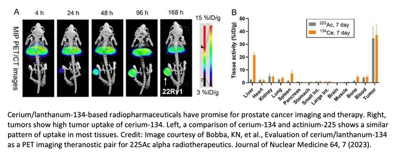Use of Monoclonal Antibodies for Alzheimer's May Cause ARIA, Requires Caution