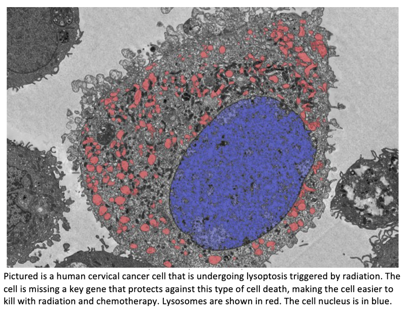Two Studies Identify Cell Death Pathway That Could Lead to New Cervical Cancer Therapies
