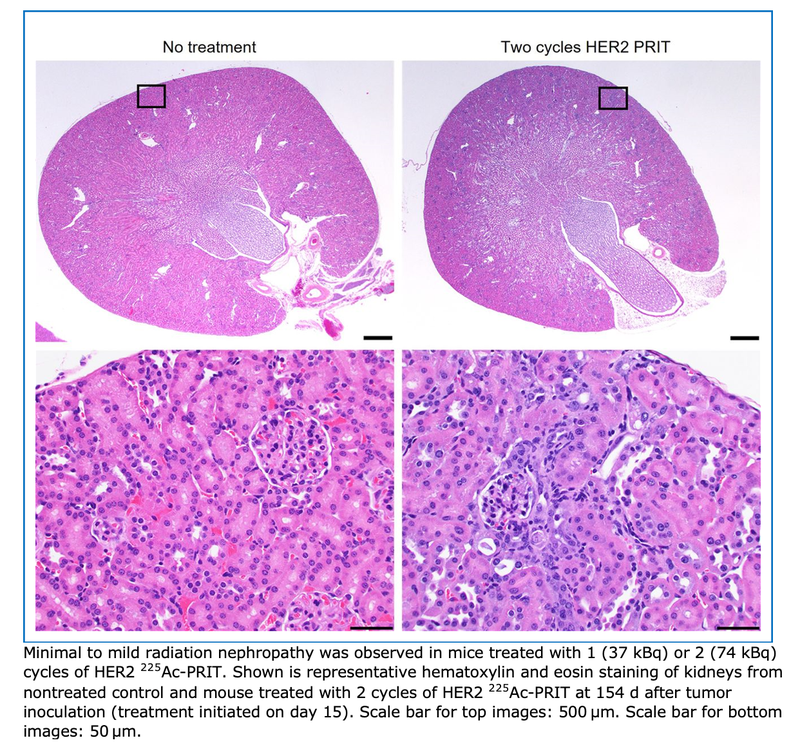 New Radioimmunotherapy Cures Epithelial Ovarian Cancer in a Preclinical Study