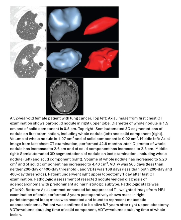 Volume Doubling Times in Part-Solid Lung Adenocarcinomas Have Greater Prognostic Importance
