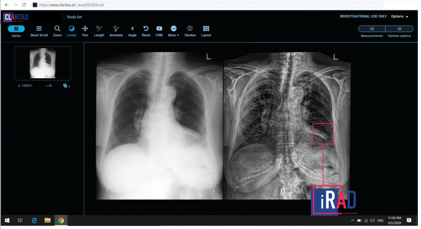 Claritas iRad Image Processing Software Gets FDA Nod