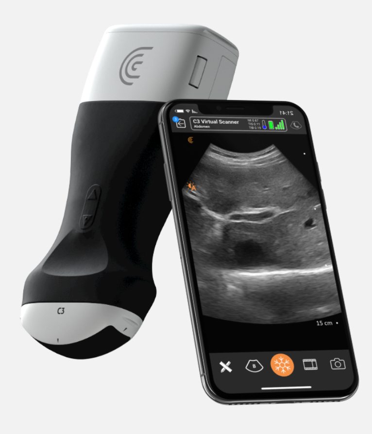 Clarius to Introduce Wireless Smartphone Ultrasound Scanner