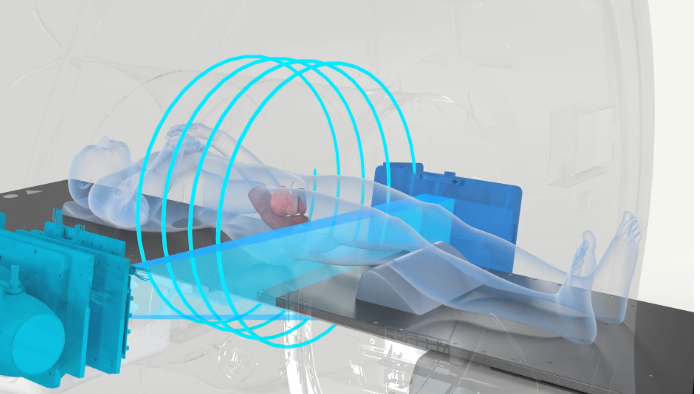 First Patient Treatments on Radixact System with ClearRT Imaging
