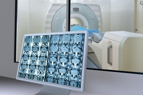 New Drug Combination Shows Promise for Prostate Cancer Treatment in Preclinical Study