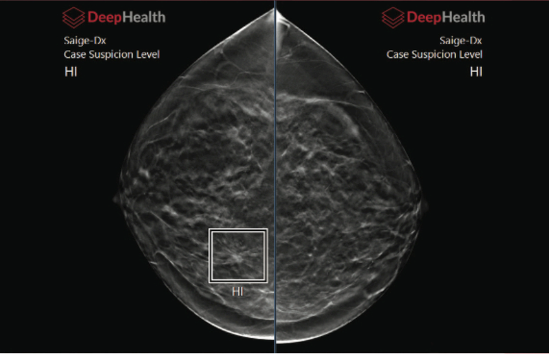 Two RadNet Subsidiaries Receive FDA Clearance for AI Algorithms