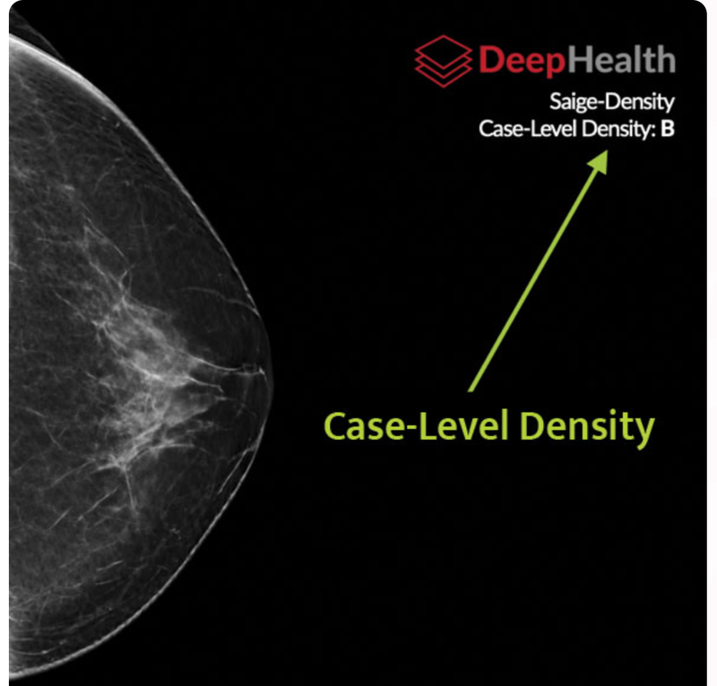 DeepHealth Nets FDA Clearance of its Third AI Mammography Product