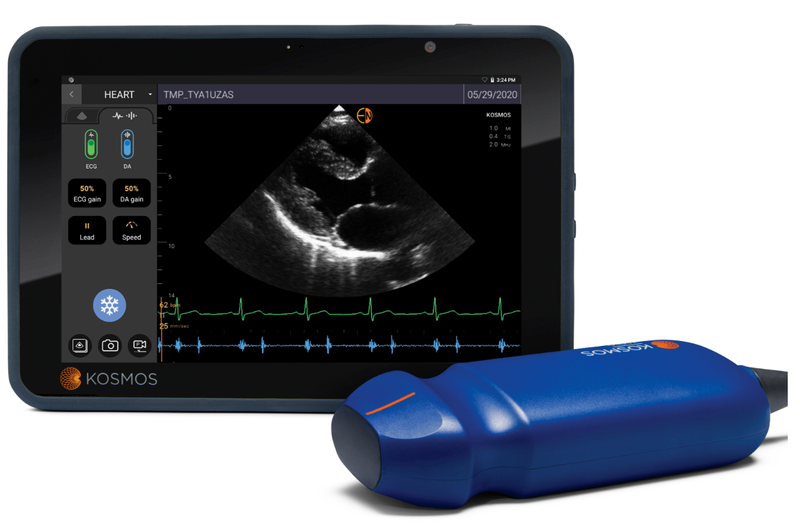 EchoNous AI-Guided Handheld Ultrasound Paired with Samsung Galaxy Tablets
