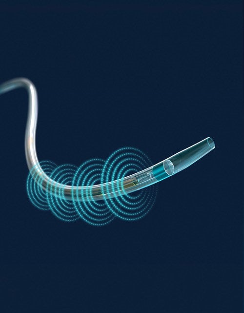 EKOS Endovascular System Shows Promise as Treatment for PE