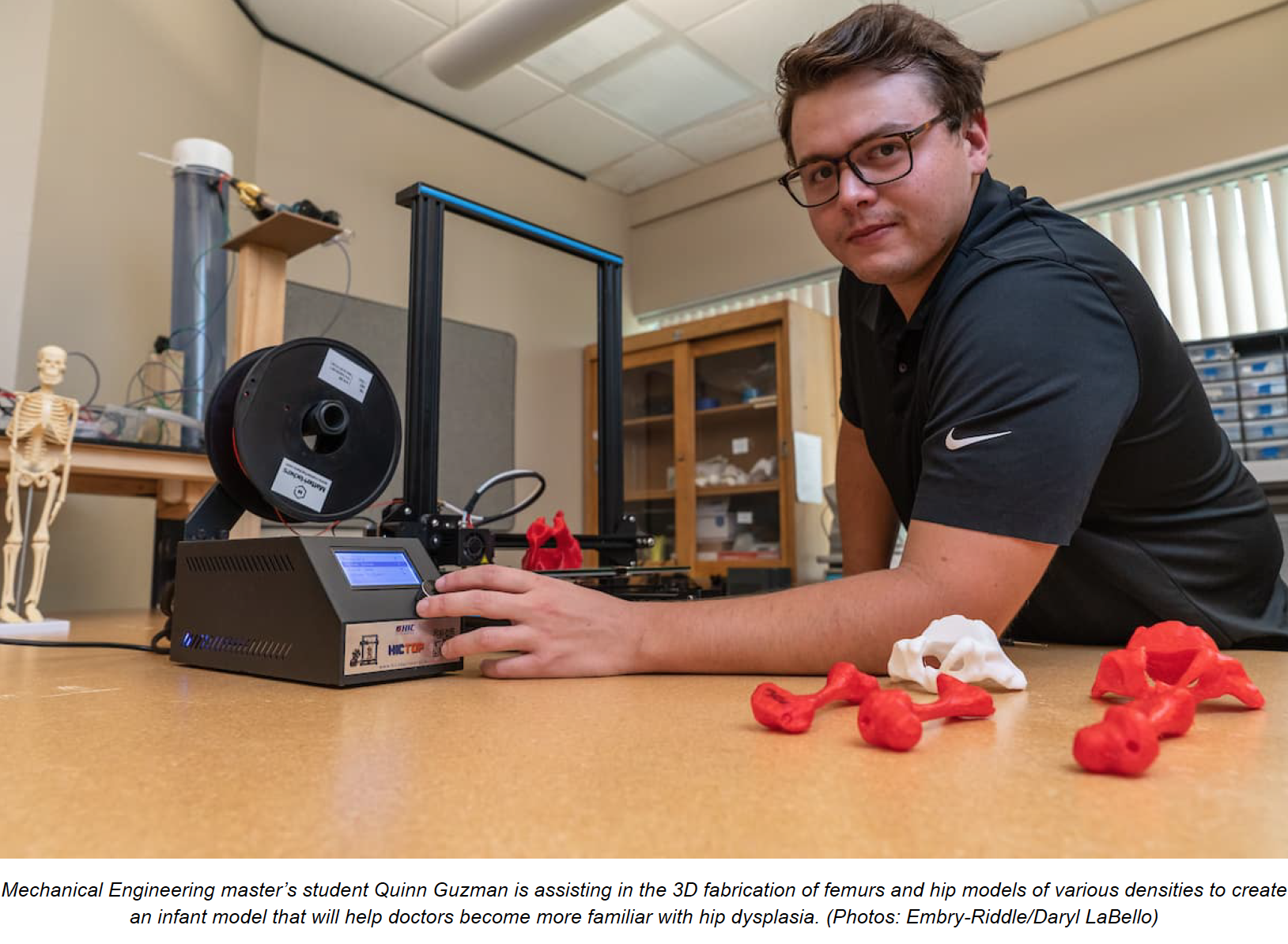 3D Printed Models May Help Babies with Hip Dysplasia
