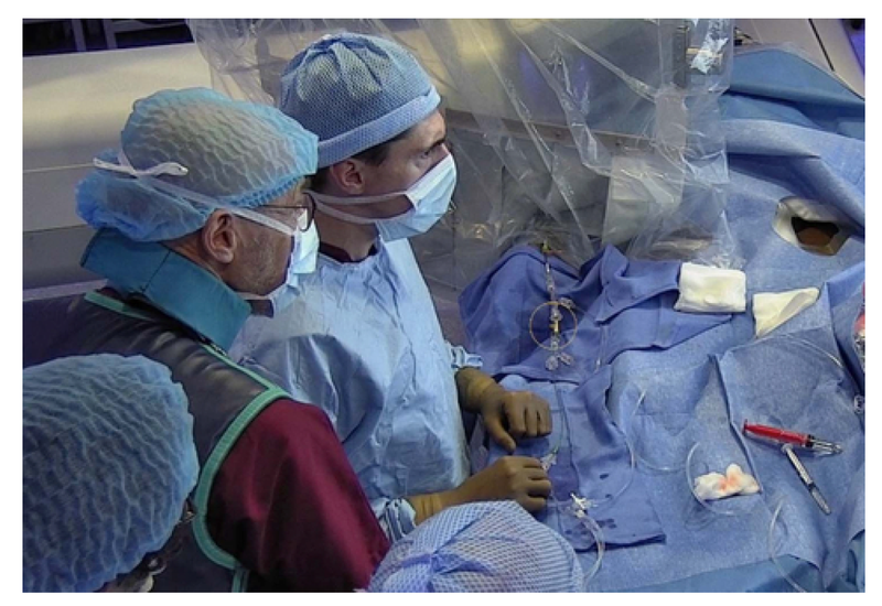 First Patient Enrolled in Study to Evaluate Device for Treating Bifurcation Aneurysms