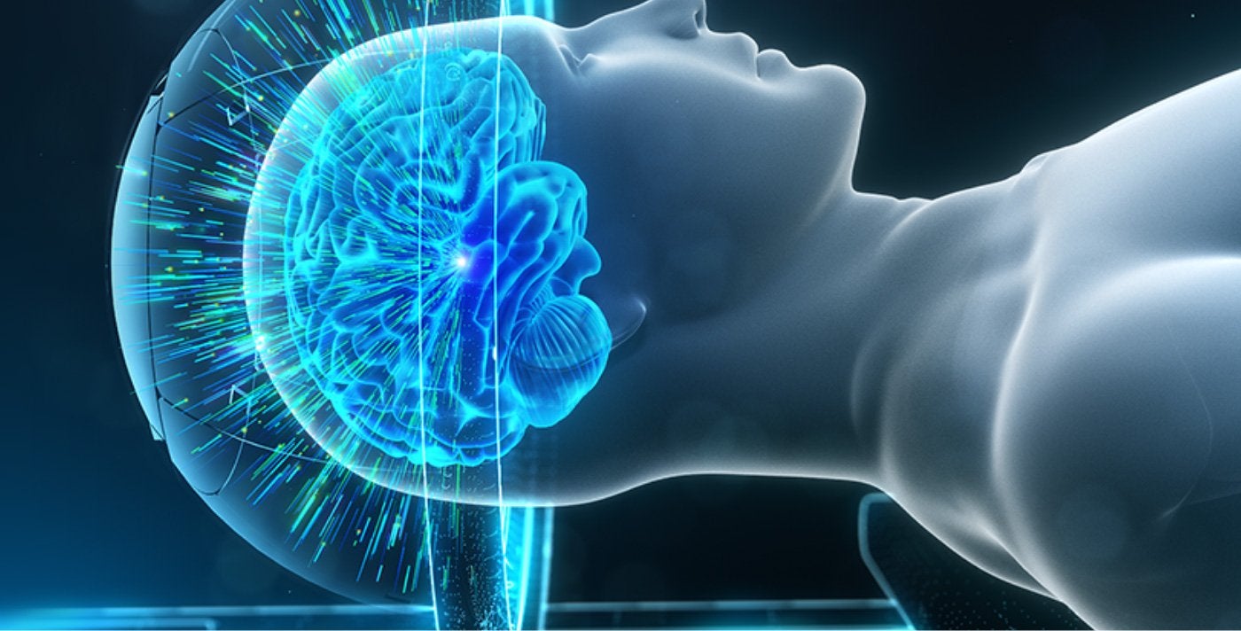 Monoclonal Antibodies With Focused Ultrasound May Slow Alzheimer Disease Progression