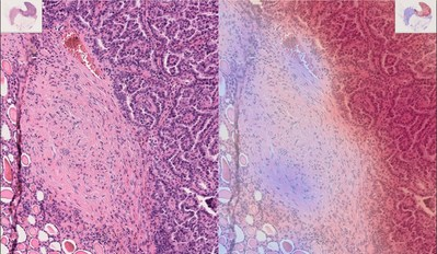 Using Explainable AI For Medical Image Processing and Cancer Screening