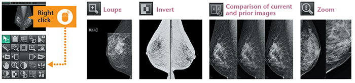 Fujifilm’s Aspire to be Fearless Campaign Brings 3D Mammography to Women Across the Country