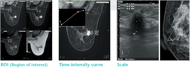 Fujifilm’s Aspire to be Fearless Campaign Brings 3D Mammography to Women Across the Country
