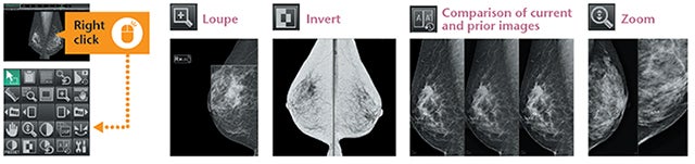 Fujifilm’s ASPIRE Cristalle Mammography System: Inspiring Diagnostic Confidence