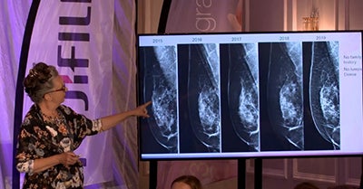 Fujifilm’s ASPIRE Cristalle Mammography System: A Radiologist’s Personal Experience