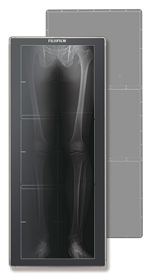 RSNA 2015: Long-length DR detector, point-of-care ultrasound