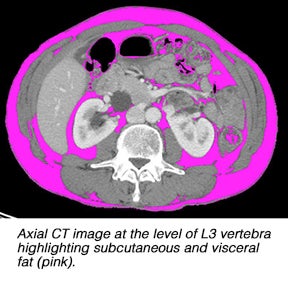 Imaging body composition may benefit treatment of cancer patients