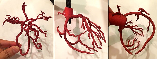 3D printing: A value-added teaching tool for radiologists