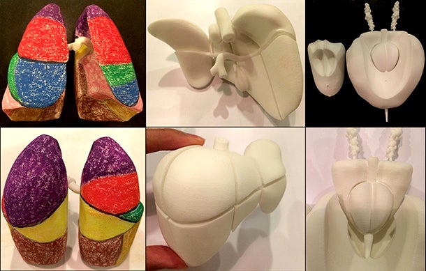 3D printing: A value-added teaching tool for radiologists