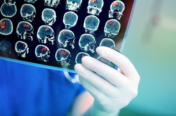 Telix Submits Revised New Drug Application for Brain Cancer Imaging Agent TLX101-Px to FDA