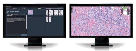 Fujifilm Completes Asset Purchase of Digital Pathology Business