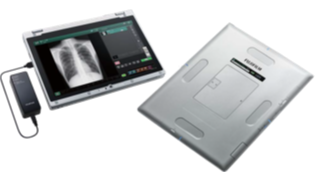 Agreement Augments X-ray with AI for Faster Interpretation