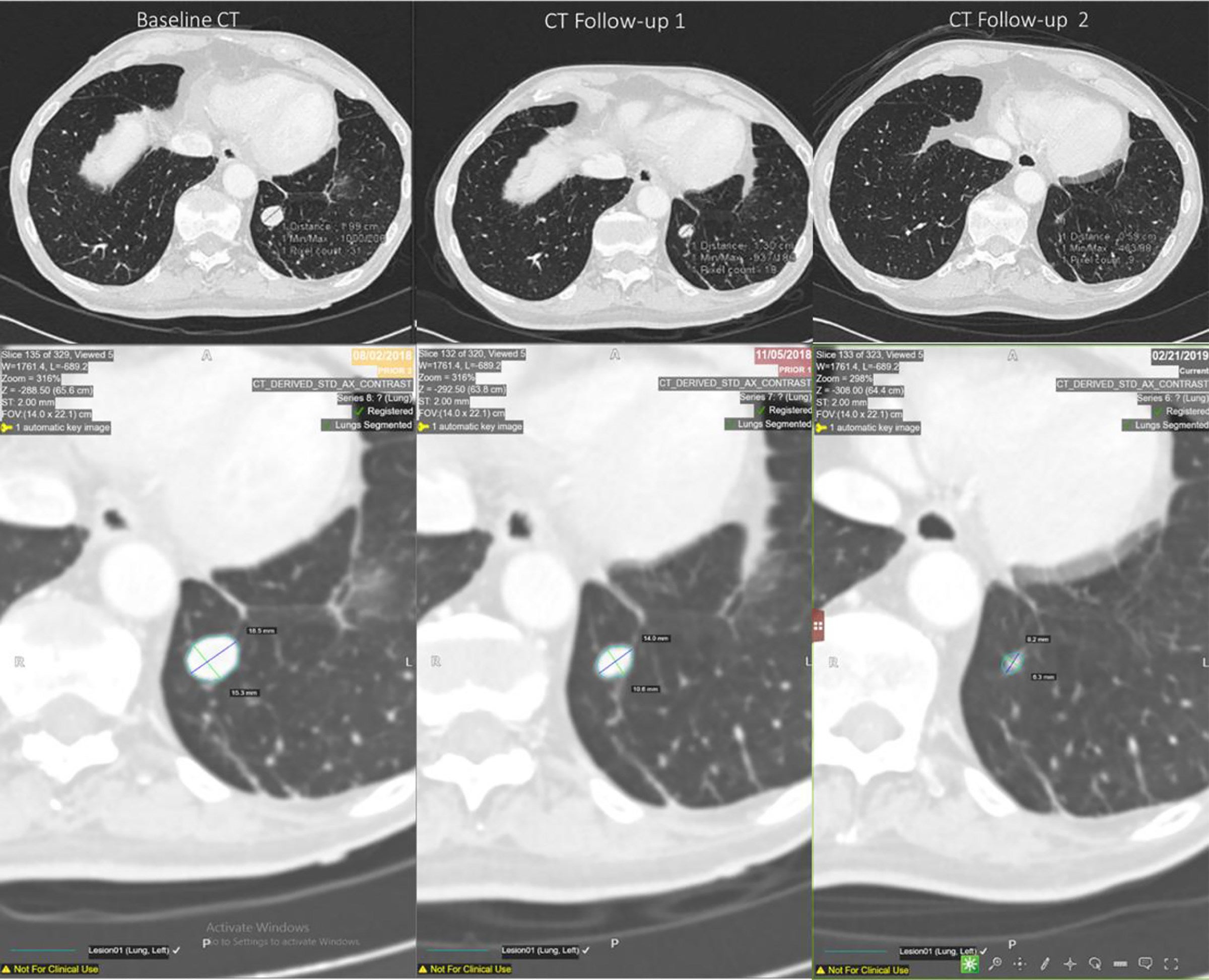 New Partnership To Provide End-To-End Radiomic Data Management And Analysis